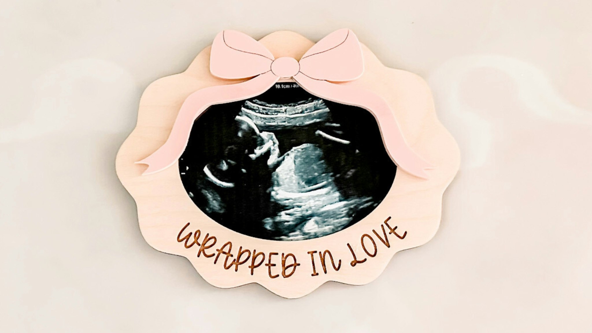 Vintage Oval Ultrasound Fridge Magnet